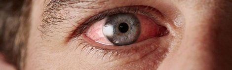 9 Tips bij allergie op je ogen
